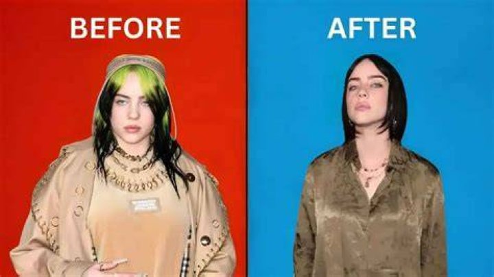 Billie Eilish Breast Reduction: A Comprehensive Look into Her Journey and Facts