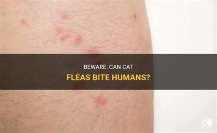 Can Cat Fleas Bite Humans? Everything You Need to Know
