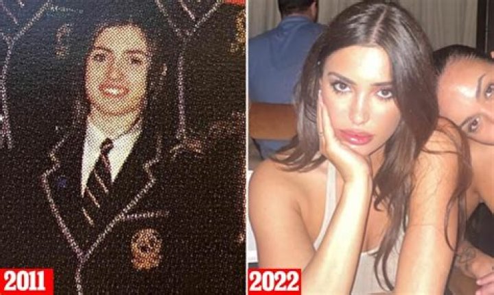 Did Bianca Censori Have Plastic Surgery? The Facts and Myths