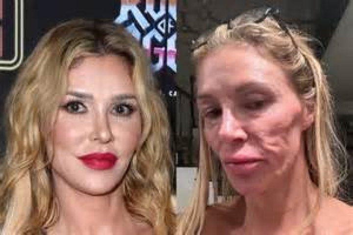 Did Brandi Glanville's Wars Get Breast Implants?