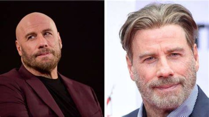 Did John Travolta Have a Stroke? Exploring the Facts and Clearing the Myths