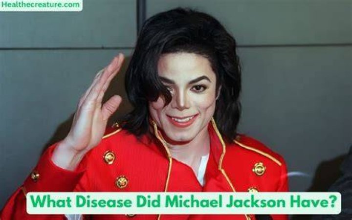 Did Michael Jackson Have a Disease? Uncovering the Truth Behind His Health