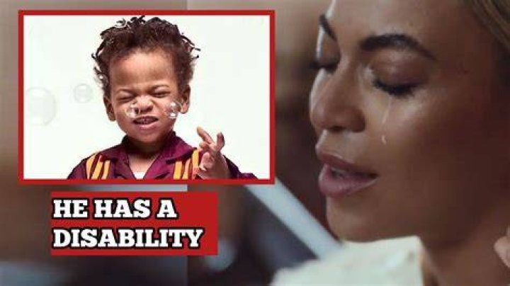 Does Beyonc&eacute; Have a Disability? Exploring the Facts and Myths
