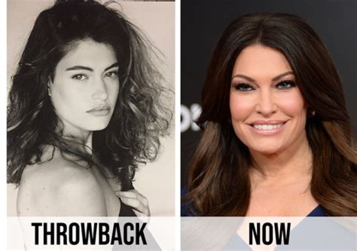Guilfoyle Before and After: A Comprehensive Transformation Journey