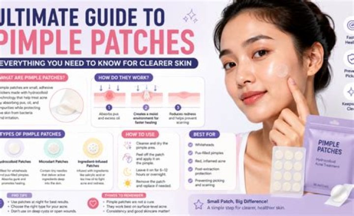 How to Ice a Pimple: The Ultimate Guide to Achieving Clear Skin