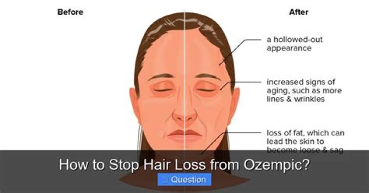 How to Stop Hair Loss from Ozempic: A Comprehensive Guide