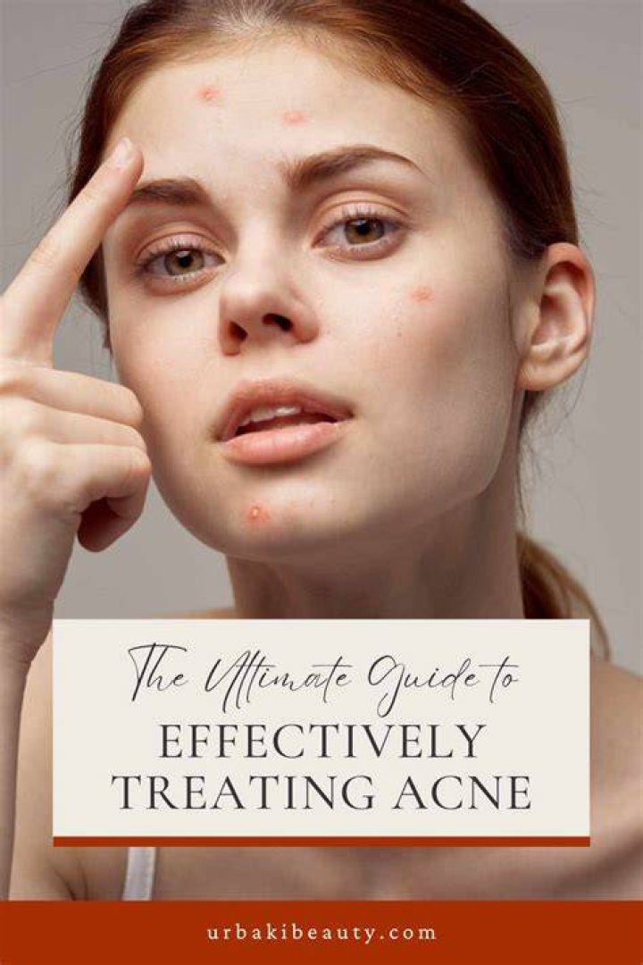 Is Ice Good for Pimples? The Ultimate Guide to Treating Acne Naturally