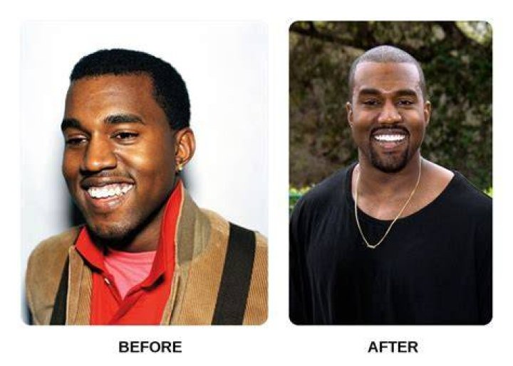 Kanye Before and After: A Detailed Exploration of His Journey
