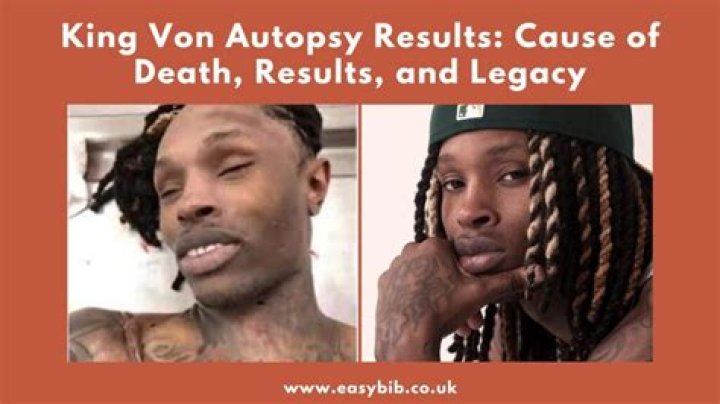 King Von Autopsy: A Detailed Examination of the Life and Legacy of a Rising Star