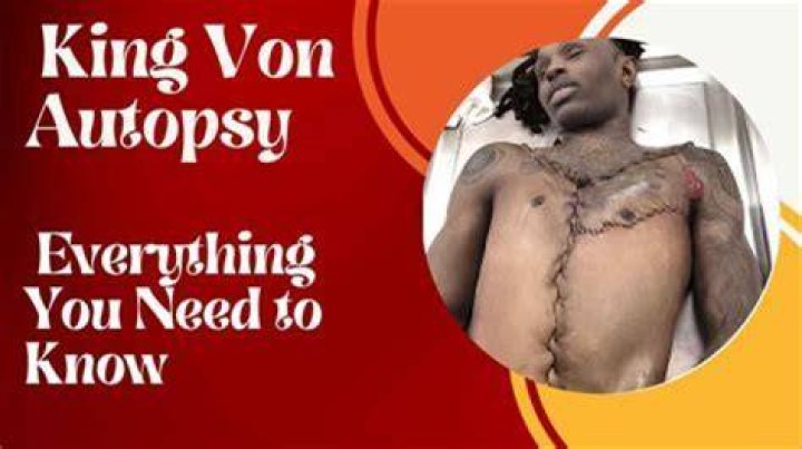 King Von Autopsy Picture: A Comprehensive Look at the Life, Legacy, and Impact