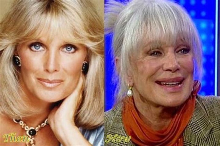 Linda Evans Today: The Iconic Actress's Journey Through Time