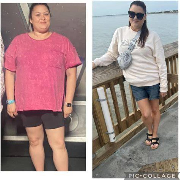 Ozempic Pics Before and After: Transformations and Success Stories