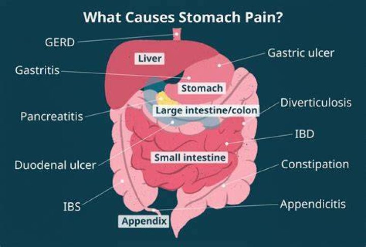 Pain in the Abdomen When Coughing: Causes, Symptoms, Diagnosis, and Treatment