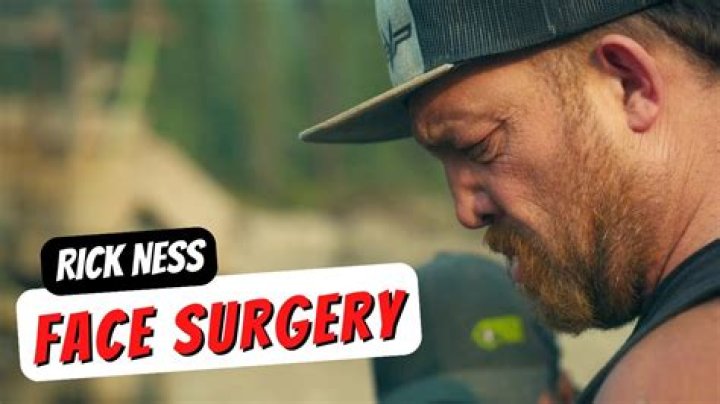Rick Ness Nose: A Comprehensive Exploration of the Phenomenon