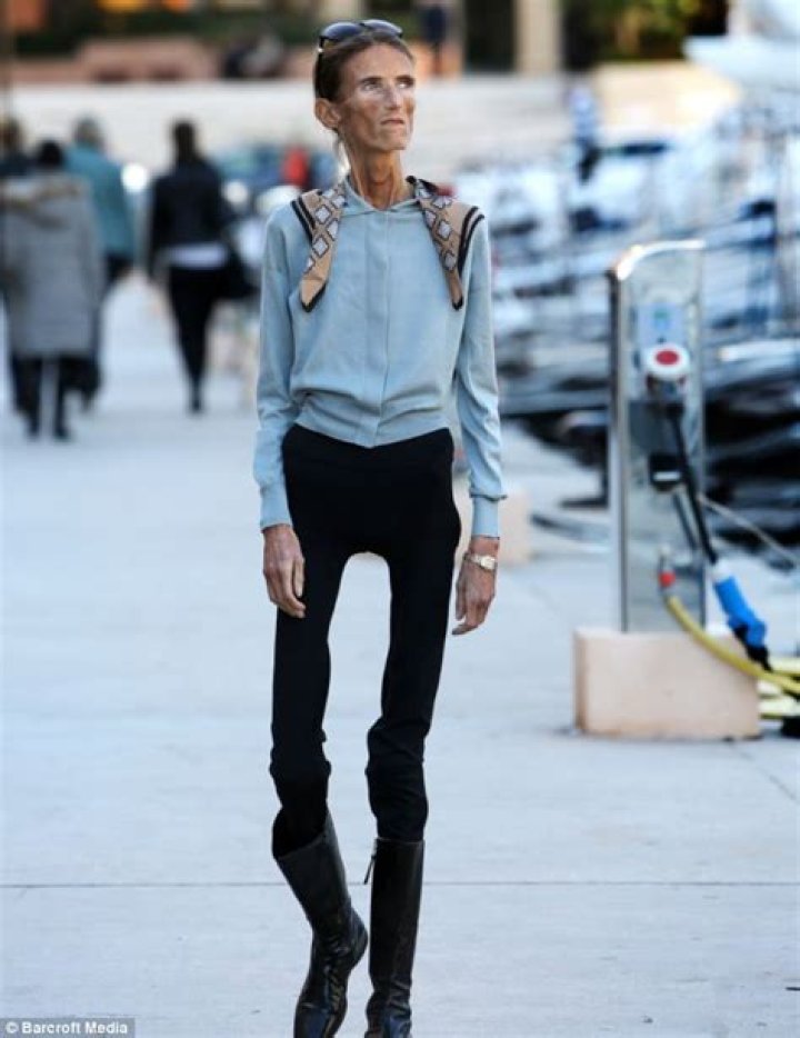 The Thinnest Person in the World: A Journey Through Health, Science, and Humanity