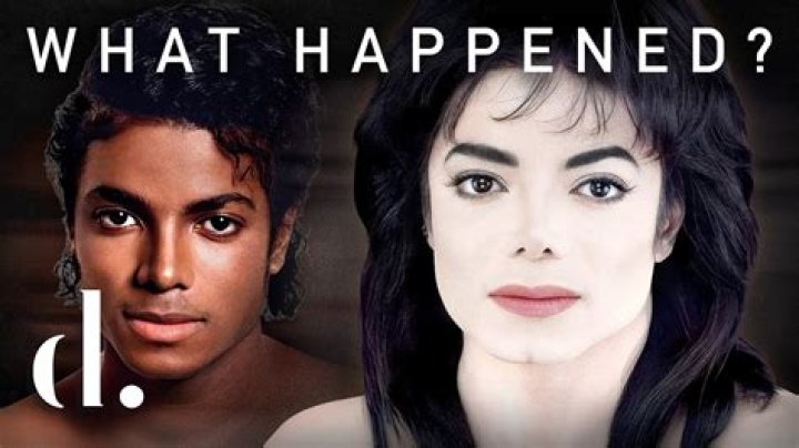 Understanding Michael Jackson's Vitiligo: A Comprehensive Guide