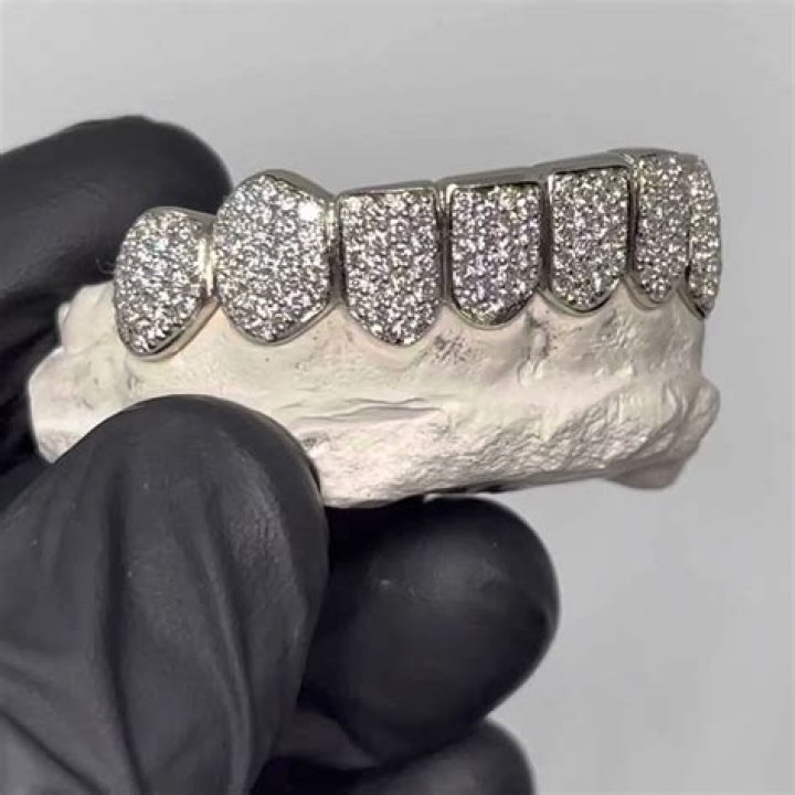 Unveiling the Flashy World of Lamar Jackson Teeth: Grillz, Style, Confidence, and More