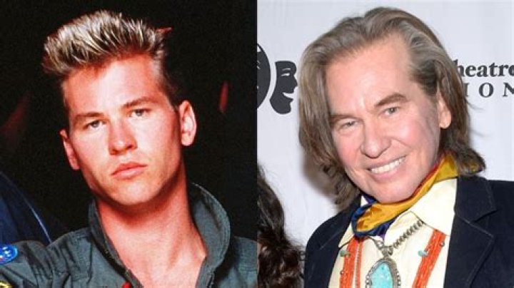 Val Kilmer's Health Condition: A Comprehensive Overview