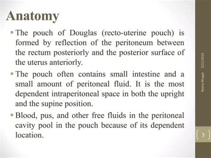 What is a Pouch of Douglas: A Comprehensive Guide to Understanding the Cul-de-sac of the Peritoneum